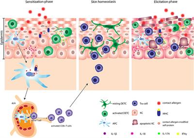 Dendritic Epidermal T Cells in Allergic Contact Dermatitis